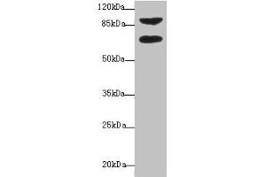 Western blot All lanes: DTX2 antibody at 1 μg/mL + HepG2 whole cell lysate Secondary Goat polyclonal to rabbit IgG at 1/10000 dilution Predicted band size: 68, 63 kDa Observed band size: 68, 92 kDa (DTX2 抗体  (AA 1-280))