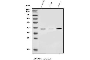 Western blot analysis of SLC25A19 using anti-SLC25A19 antibody (ABIN7603155).