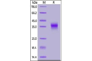SDS-PAGE (SDS) image for Folate Receptor 1 (Adult) (FOLR1) (AA 25-233) (Active) protein (His tag) (ABIN5674653)