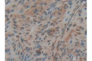 Detection of RANk in Rat Ovary Tissue using Polyclonal Antibody to Receptor Activator Of Nuclear Factor Kappa B (RANk)