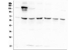 Western blot analysis of AKT2 using anti-AKT2 antibody (ABIN6719267).