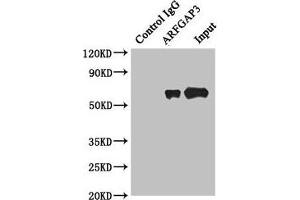 Immunoprecipitating ARFGAP3 in HepG2 whole cell lysate Lane 1: Rabbit control IgG instead of (1 μg) instead of ABIN7143462 in HepG2 whole cell lysate. (ARFGAP3 抗体  (AA 217-516))