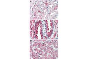 Immunohistochemical staining of formalin-fixed, paraffin-embedded human kidney (A), human prostate (B) and human liver (C) tissue after heat-induced antigen retrieval. (GPR146 抗体  (Internal Region))