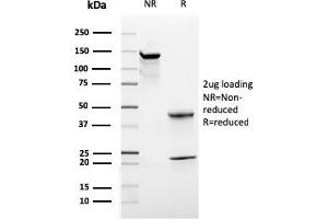 Western Blotting (WB) image for anti-CD44 (CD44) antibody (ABIN6941200)