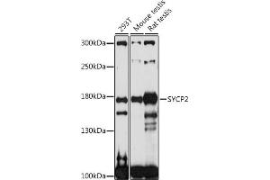 Western blot analysis of extracts of various cell lines, using SYCP2 antibody (ABIN7270668) at 1:1000 dilution. (SYCP2 抗体  (AA 1231-1530))