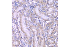 Immunohistochemistry of paraffin-embedded rat kidney using ACAA1 antibody (ABIN4902819) at dilution of 1:100 (40x lens). (ACAA1 抗体)