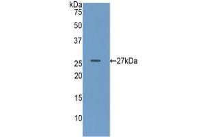 Western blot analysis of recombinant Human GUSb. (Glucuronidase beta 抗体  (AA 451-649))