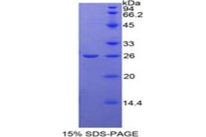SDS-PAGE analysis of Rat NAGase Protein. (MGEA5 蛋白)