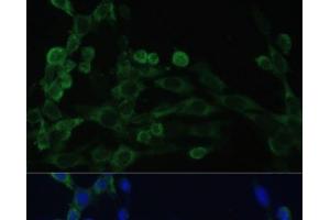 Immunofluorescence analysis of NIH/3T3 cells using EEF1B2 Polyclonal Antibody at dilution of 1:100. (EEF1B2 抗体)