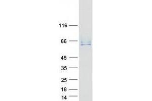 Western Blotting (WB) image for Anthrax Toxin Receptor 2 (ANTXR2) (Transcript Variant 2) protein (Myc-DYKDDDDK Tag) (ABIN2714758)