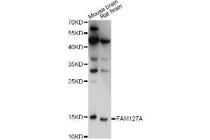 Western blot analysis of extracts of various cell lines, using FAM127A antibody. (CXX1 抗体)