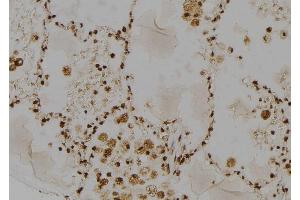 ABIN6264614 and ABIN6277485 at 1/100 staining Human lung tissue by IHC-P. (RAD23A 抗体  (C-Term))