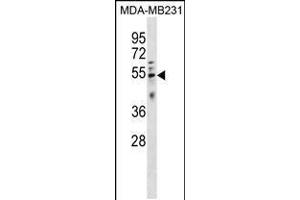 Western blot analysis in MDA-MB231 cell line lysates (35ug/lane). (HTRA4 抗体  (AA 283-311))