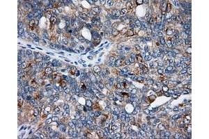 Immunohistochemical staining of paraffin-embedded Kidney tissue using anti-SIL1 mouse monoclonal antibody. (SIL1 抗体)