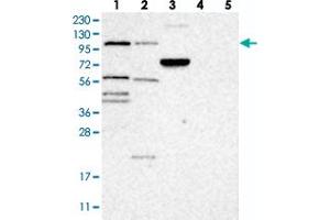 Western blot analysis of Lane 1: RT-4, Lane 2: U-251 MG, Lane 3: Human Plasma, Lane 4: Liver, Lane 5: Tonsil with TTLL4 polyclonal antibody . (TTLL4 抗体)