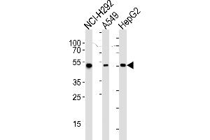 Western blot analysis of lysates from NCI-, A549, HepG2 cell line (from left to right), using ALDH2 Antibody (ABIN658993 and ABIN2838036). (ALDH2 抗体)