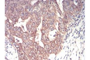Immunohistochemistry (IHC) image for anti-Emerin (EMD) (AA 1-222) antibody (ABIN5864847) (Emerin 抗体  (AA 1-222))