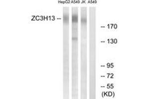 Western blot analysis of extracts from A549/Jurkat/HepG2 cells, using ZC3H13 Antibody. (ZC3H13 抗体  (AA 1571-1620))