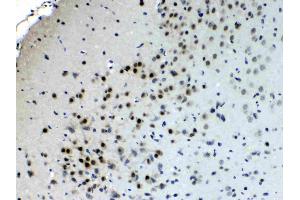 IHC analysis of CHAT using anti- CHAT antibody . (Choline Acetyltransferase 抗体  (AA 446-652))