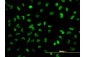 Immunofluorescence of monoclonal antibody to SNAI2 on HeLa cell.
