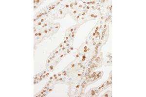 Immunohistochemistry (IHC) image for anti-Karyopherin (Importin) alpha 4 (KPNA4) (AA 471-521) antibody (ABIN7453718)