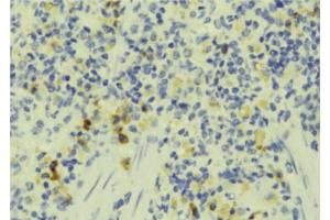 ABIN6273242 at 1/100 staining Human lymph tissue by IHC-P. (FAM65B 抗体)