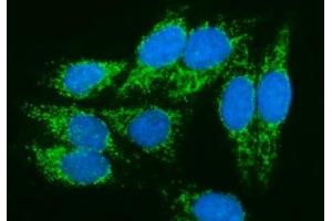 IF analysis of PMPCA/INPP5 using anti-PMPCA/INPP5 antibody (ABIN7602722). (PMPCA 抗体  (AA 99-525))
