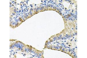 Immunohistochemistry (Paraffin-embedded Sections) (IHC (p)) image for anti-Src Kinase Associated Phosphoprotein 2 (SKAP2) antibody (ABIN7011120)