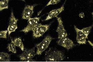 Immunofluorescence staining of HeLa cells (Human cervical epitheloid carcinoma, ATCC CCL-2. (BDKRB2 抗体  (AA 350-364))