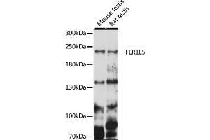 Western blot analysis of extracts of various cell lines, using FER1L5 antibody (ABIN7267166) at 1000 dilution. (FER1L5 抗体  (AA 1350-1670))