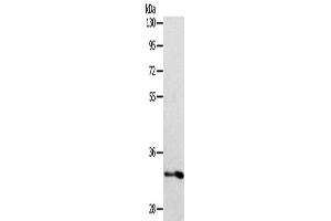 Western Blotting (WB) image for anti-Interleukin 1 Receptor-Like 1 (IL1RL1) antibody (ABIN2422347) (IL1RL1 抗体)