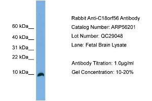 WB Suggested Anti-C18orf56  Antibody Titration: 0. (C18orf56 抗体  (N-Term))