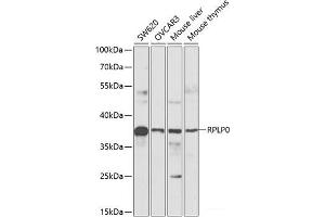 Western blot analysis of extracts of various cell lines using RPLP0 Polyclonal Antibody at dilution of 1:1000. (RPLP0 抗体)