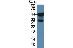 Western blot analysis of Human Lung lysate, using Human TKA1 Antibody (3 µg/ml) and HRP-conjugated Goat Anti-Rabbit antibody ( (SLC9A3R2 抗体  (AA 56-337))