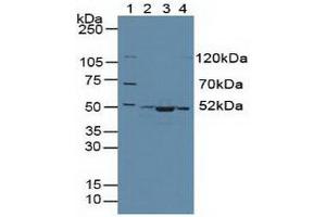 Western blot analysis of (1) Human 293T Cells, (2) Human HeLa cells, (3) Mouse Skeletal Muscle Tissue and (4) Human HepG2 Cells. (CS 抗体  (AA 174-428))
