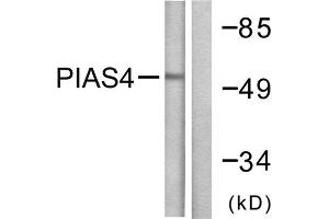 Western Blotting (WB) image for anti-Protein Inhibitor of Activated STAT, 4 (PIAS4) (C-Term) antibody (ABIN1848838) (PIAS4 抗体  (C-Term))