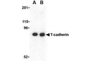 Western Blotting (WB) image for anti-Cadherin 13 (CDH13) (N-Term) antibody (ABIN2477830) (Cadherin 13 抗体  (N-Term))