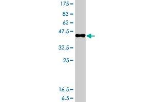 Western Blot detection against Immunogen (37. (GTSE1 抗体  (AA 621-720))