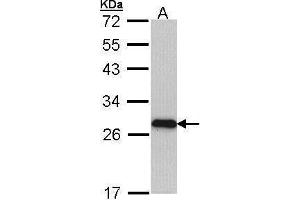 WB Image Sample (30 ug of whole cell lysate) A: Molt-4 , 12% SDS PAGE antibody diluted at 1:1000 (MYL3/CMLC1 抗体)