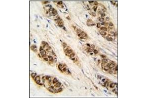 Image no. 2 for anti-DCTP Pyrophosphatase 1 (DCTPP1) (N-Term) antibody (ABIN357989) (DCTPP1 抗体  (N-Term))