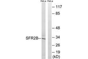Western blot analysis of extracts from HeLa cells, using SFRS2B Antibody. (SFRS2B 抗体  (AA 31-80))