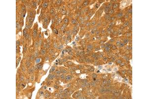 Immunohistochemistry (IHC) image for anti-Transmembrane Protein with EGF-Like and Two Follistatin-Like Domains 2 (TMEFF2) antibody (ABIN2434016) (TMEFF2 抗体)