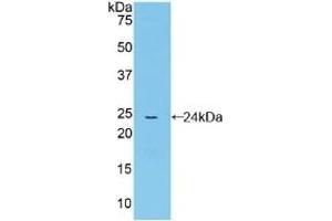 Detection of Recombinant CYPD, Mouse using Polyclonal Antibody to Cyclophilin 40 (CYP-40) (PPID 抗体  (AA 9-189))