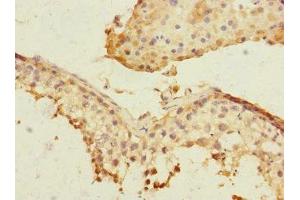 Immunohistochemistry of paraffin-embedded human testis tissue using ABIN7169162 at dilution of 1:100 (PLK3 抗体  (AA 487-646))