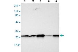 Western blot analysis of lane 1: RT-4, lane 2: U-251 MG, lane 3: A-431, lane 4: Liver and lane 5: Tonsil using SNAP23 polyclonal antibody . (SNAP23 抗体)
