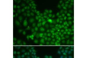 Immunofluorescence analysis of U2OS cells using CLU Polyclonal Antibody (Clusterin 抗体)