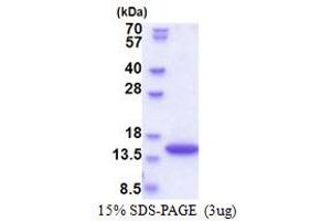 SDS-PAGE (SDS) image for Synaptojanin 2 Binding Protein (SYNJ2BP) (AA 1-117) protein (His tag) (ABIN5853559) (SYNJ2BP Protein (AA 1-117) (His tag))