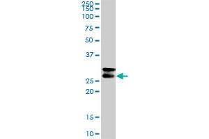 CD99 MaxPab rabbit polyclonal antibody. (CD99 抗体  (AA 1-185))