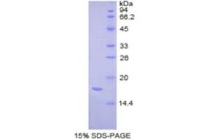 SDS-PAGE analysis of Human Complexin 2 Protein. (CPLX2 蛋白)