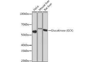 Western blot analysis of extracts of various cell lines, using Glucokinase (GCK) (GCK) Rabbit mAb (ABIN7267396) at 1:1000 dilution. (GCK 抗体)